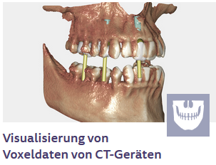Dicom Viewer